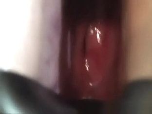 Gaping Anal Speculum Stretching And Dildo Fuck
